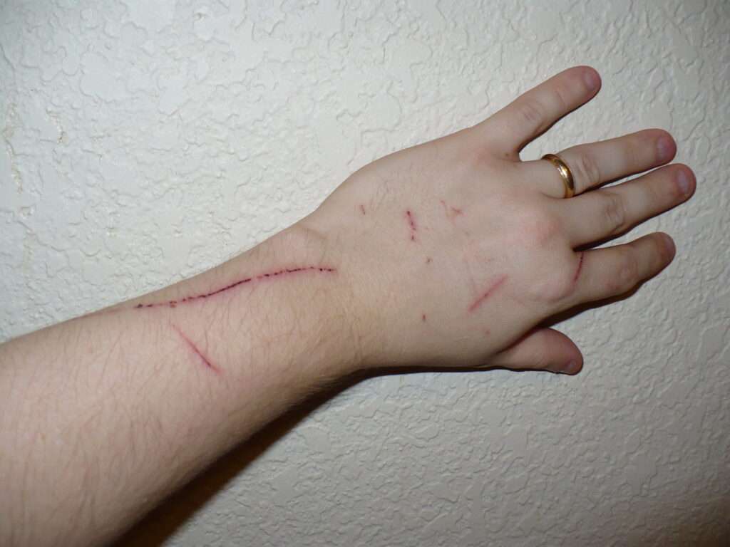 why do cat scratches burn